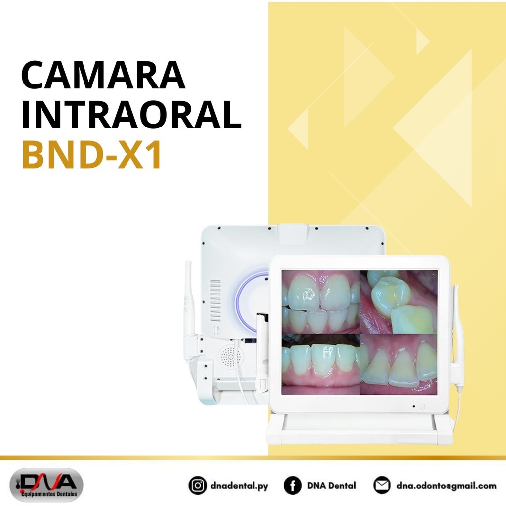Camara Intraoral X1 con soporte y monitor 19' sensor 1/4 cmos Captura y Graba (Foshan)
