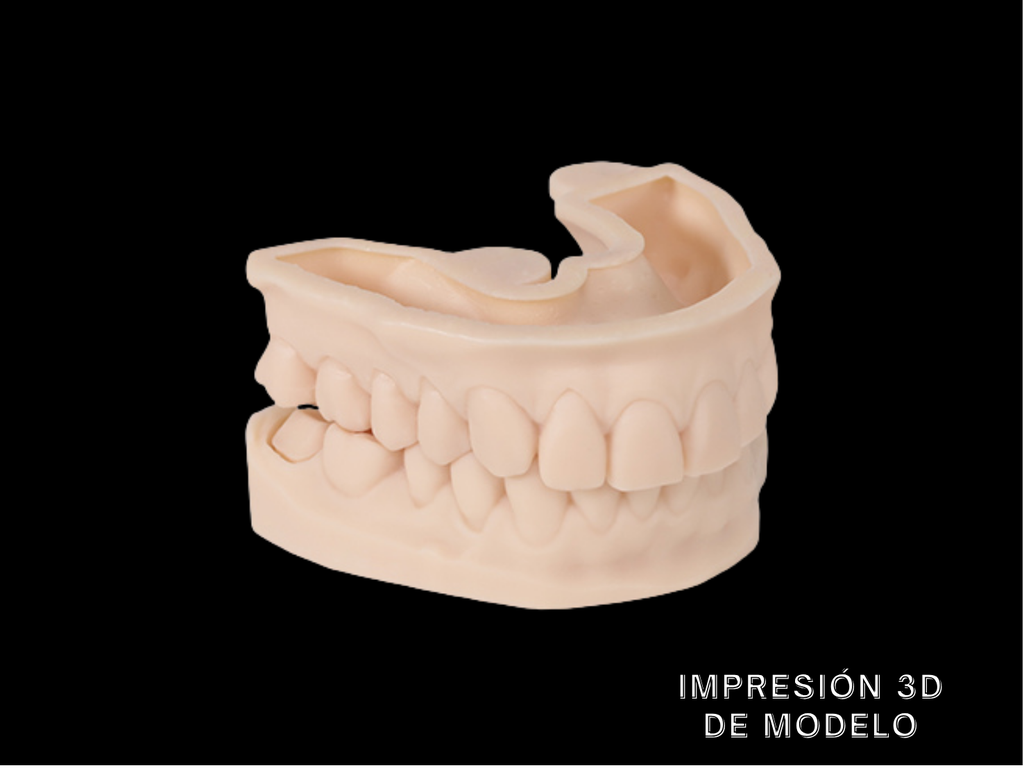 Impresión 3D de modelo de Estudio (por maxilar)