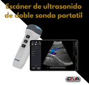 Escáner de ultrasonido de doble sonda portatil 