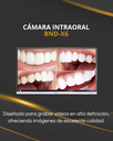 Camara intraoral BND X6 (copia)