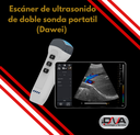 Escáner de ultrasonido de doble sonda portatil (Dawei)